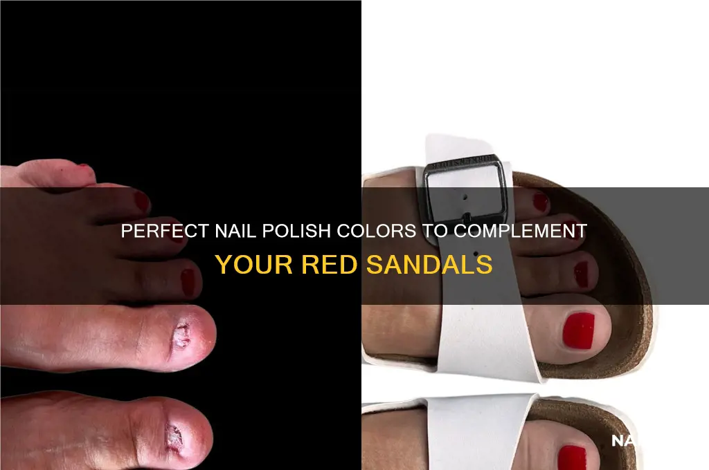 what colour nail varnish with red sandals