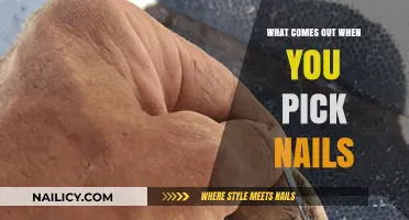 What's Underneath? Exploring What Comes Out When You Pick Nails