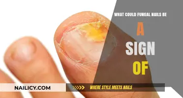 Fungal Nails: Uncovering Hidden Health Issues and Underlying Causes