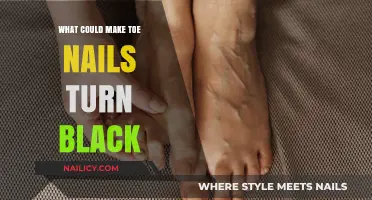 Why Toe Nails Turn Black: Causes, Concerns, and Solutions Explained