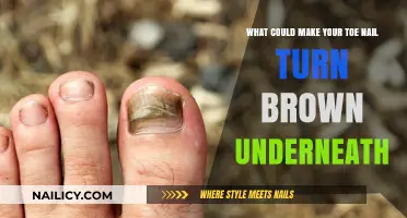 Why Your Toenail Turns Brown: Causes and Solutions Explained