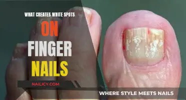 Uncover the Mystery: Causes of White Spots on Your Nails