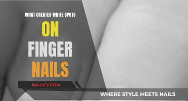 White Spots on Fingernails: What's the Underlying Cause?