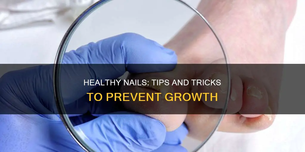 what cure the grow of nail
