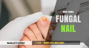 Effective Remedies to Treat Fungal Nail Infections
