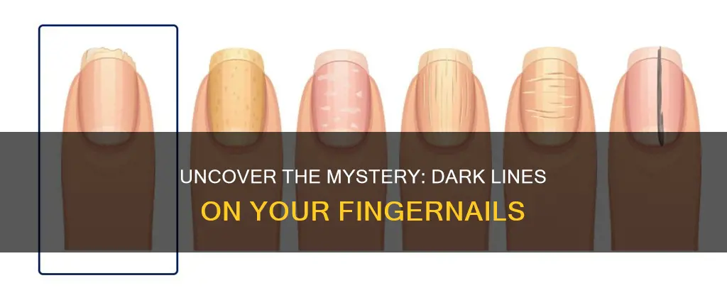 what dark lines on your finger nails mean