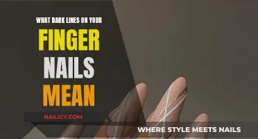 Dark Lines on Fingernails: What Do They Mean?