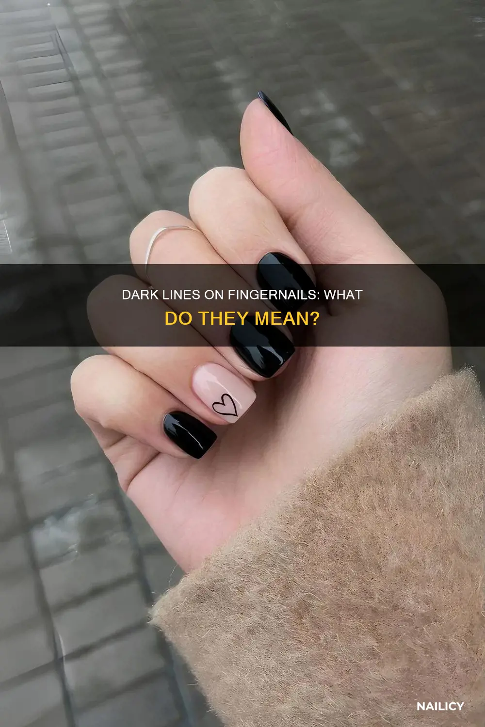 what dark lines on your finger nails mean