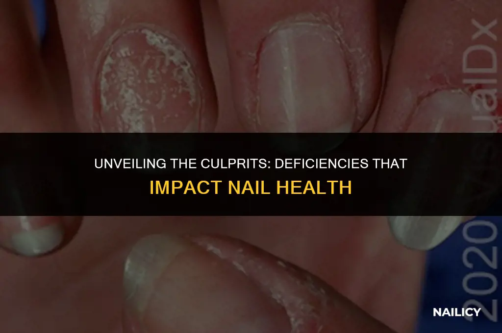 what deficiency affects nails