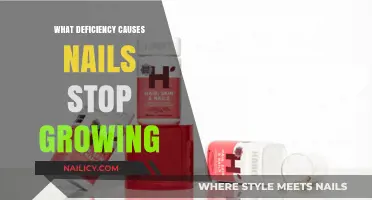 Nail Growth and Nutritional Deficiency: What's the Link?