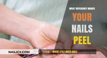 Nail Peeling Causes: Uncovering the Vitamin Deficiency Behind Brittle Nails