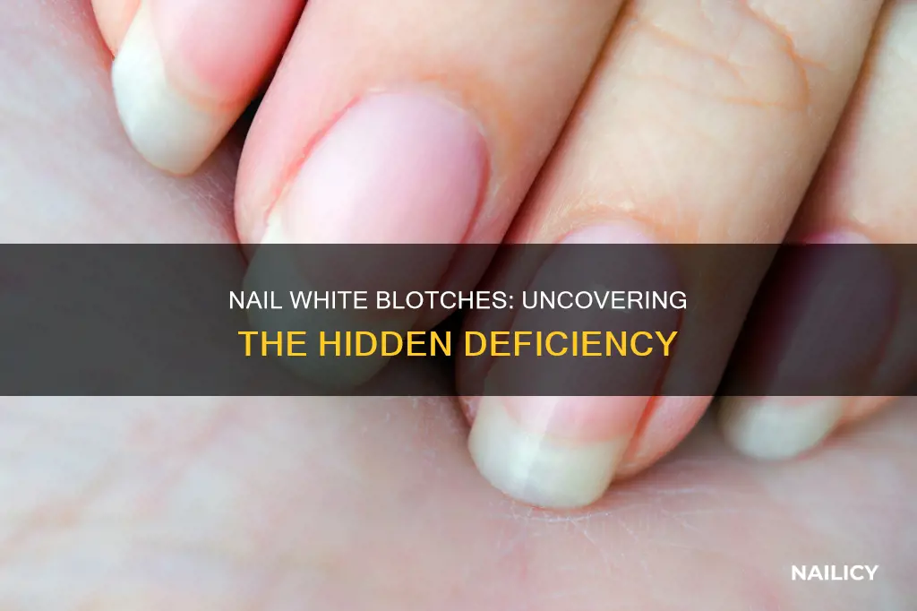 what deficiency means white blotches on the nails