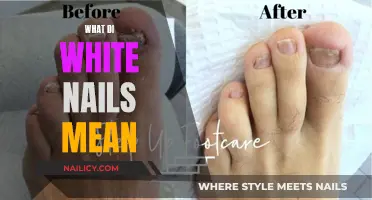 Unraveling the Mystery: What Do White Nails Indicate?