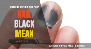 Unraveling the Mystery: What Does a Black Splice in Your Pinky Nail Mean?