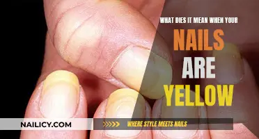 Yellow Nails: Uncover the Hidden Health Message