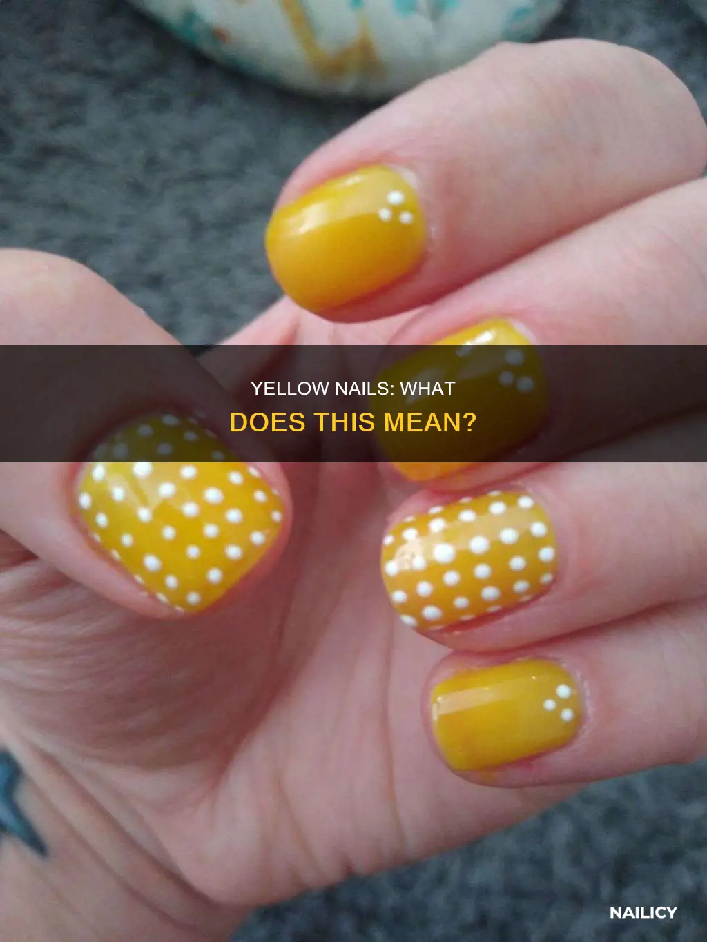 what dies it mean when your nails are yellow