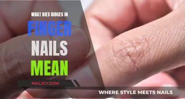 Unraveling the Mystery: What Do Ridges in Your Nails Indicate?