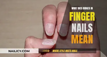 Ridges in Fingernails: What Do They Mean?