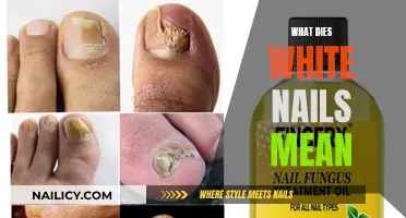 Unraveling the Mystery: What White Nails Could Indicate