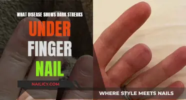 Unveiling the Mystery: Dark Streaks Beneath Your Fingernails