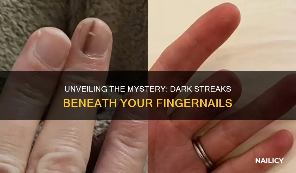 what disease shows dark streaks under finger nail