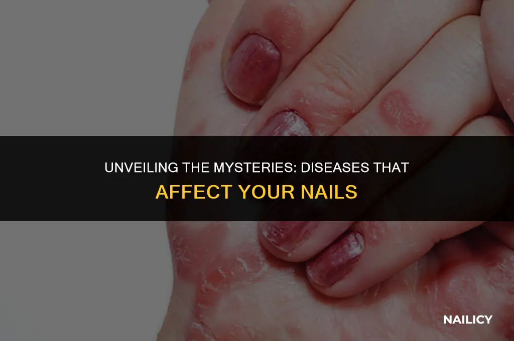 what diseases affect nails