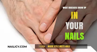 Unveiling Health Secrets: Diseases That Manifest in Your Fingernails