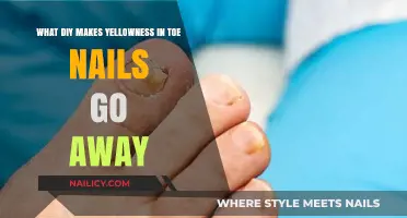 DIY Remedies to Banish Yellow Toenails Naturally and Effectively