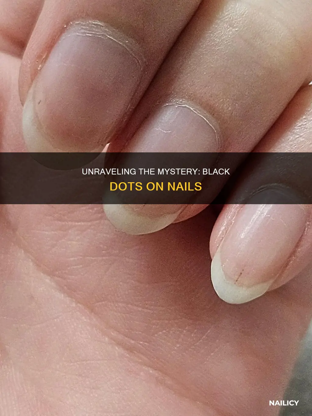 what do black dots on nails mean