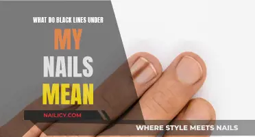 Unraveling the Mystery: Black Lines Under Your Nails