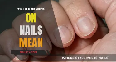 Unraveling the Mystery: What Do Black Stripes on Nails Indicate?