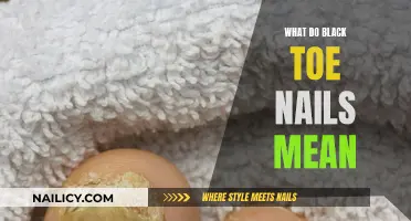 Black Toenails: What Do They Mean?