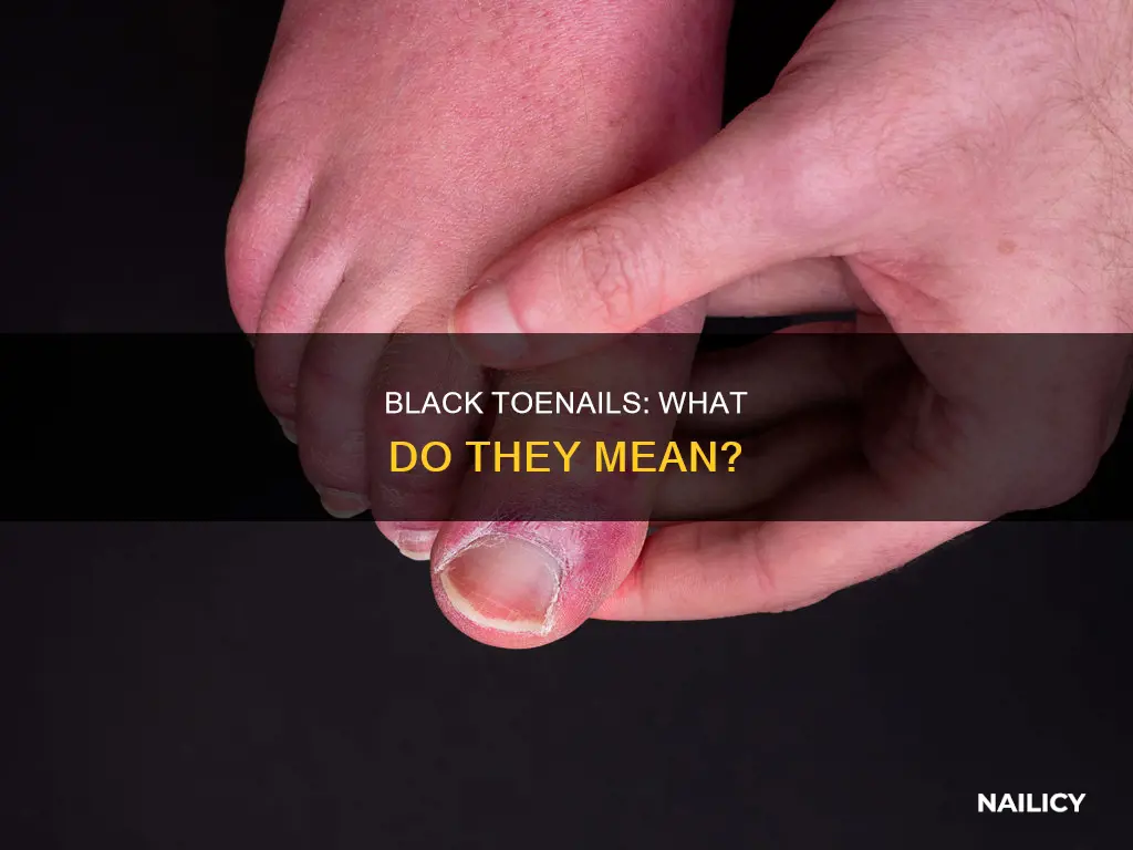 what do black toe nails mean