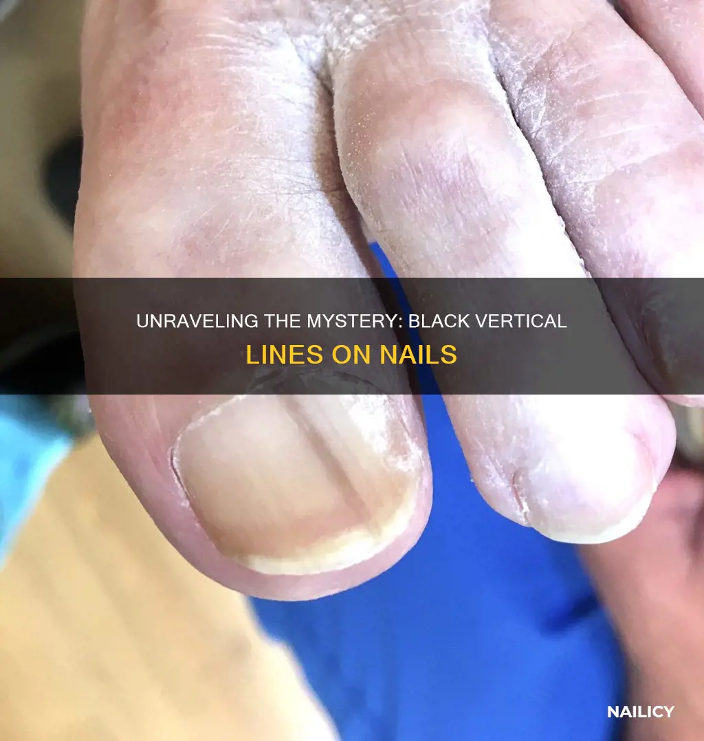 what do black vertical lines on nails mean