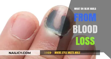 Understanding Blue Nails: Causes and Effects of Blood Loss