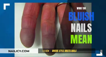 Uncover the Mystery: What Do Bluish Nails Indicate?