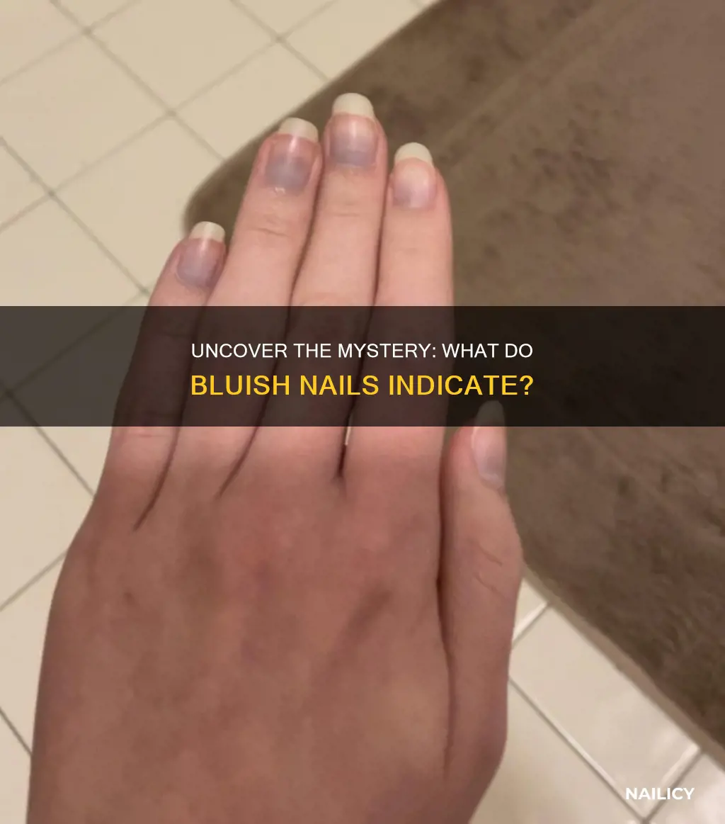 what do bluish nails mean