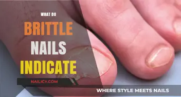 Decoding Brittle Nails: Signs, Symptoms, and Solutions