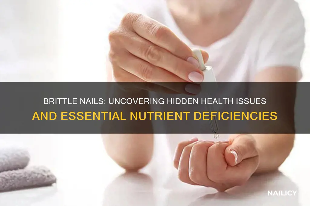 what do brittle nails say about your health