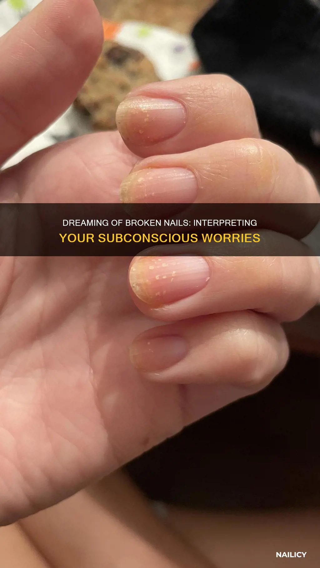 what do broken nails mean in a dream