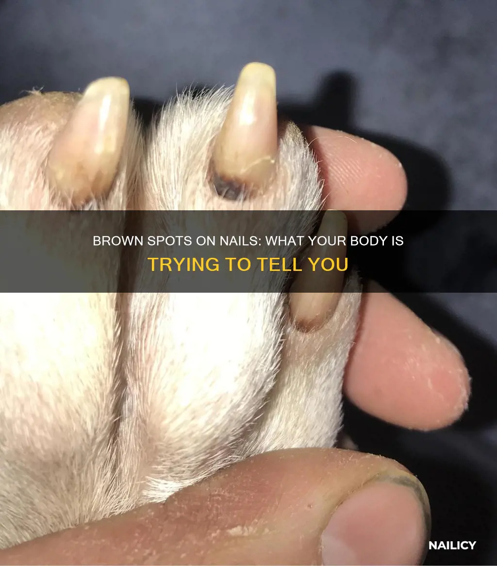 what do brown spots on nails mean