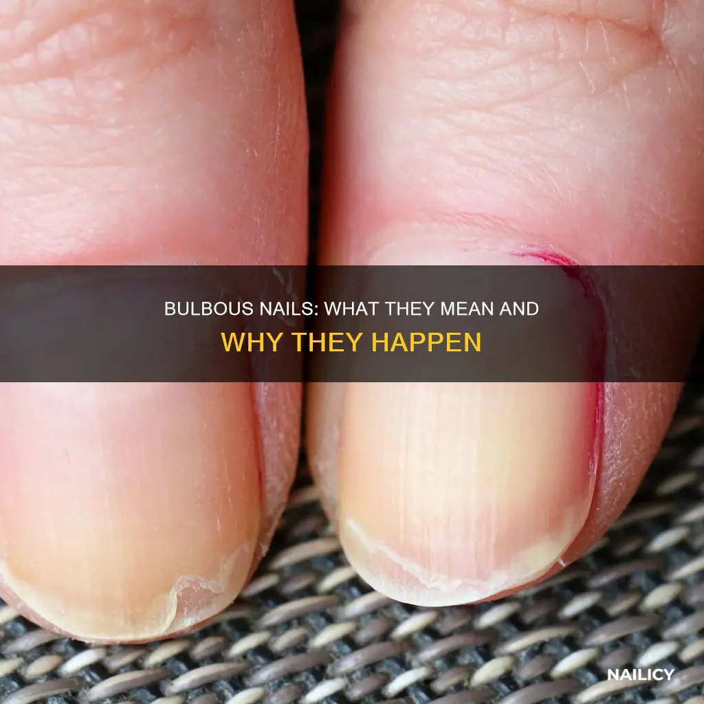 what do bulbous nails mean