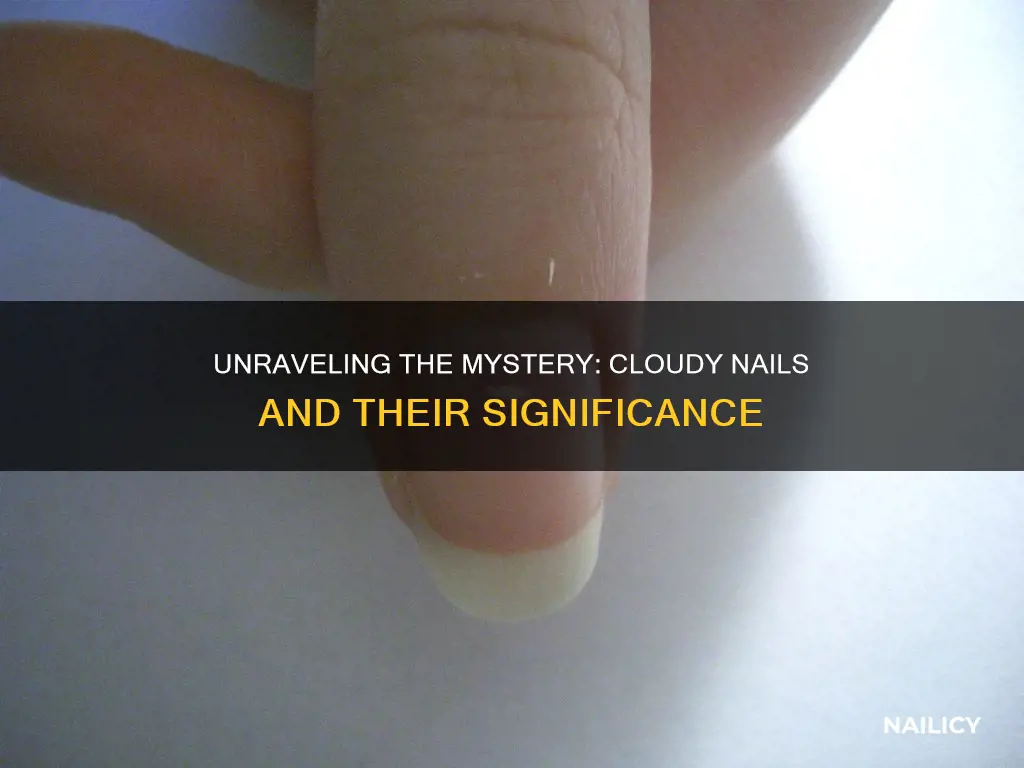 what do cloudy nails mean