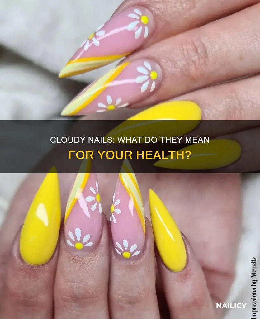 what do cloudy nails mean