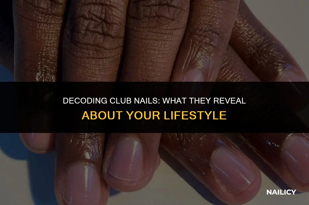 what do club nails indicate
