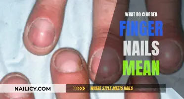 Unraveling the Mystery: Clubbed Nails and Their Meaning