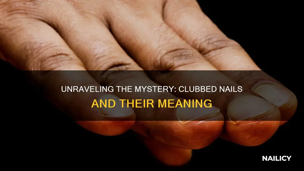 what do clubbed finger nails mean