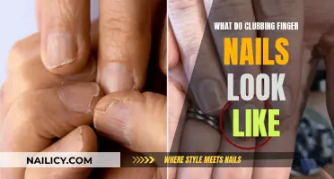 Clubbing: Understanding the Unique Shape of Finger Nails