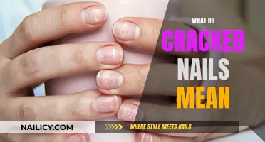 Unraveling the Mystery: What Your Cracked Nails Might Reveal