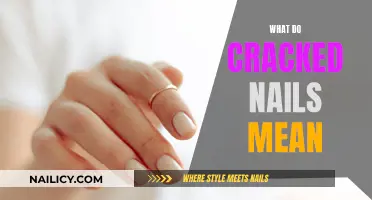 Cracked Nails: What Your Body is Trying to Tell You